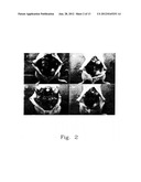 PHARMACEUTICAL COMPOSITION FOR INHIBITING PERITONEAL DISSEMINATION diagram and image