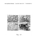 PHARMACEUTICAL COMPOSITION FOR INHIBITING PERITONEAL DISSEMINATION diagram and image