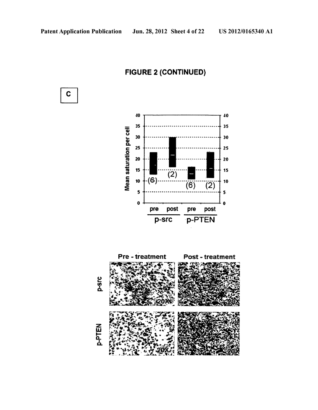 PTEN PHOSPHORYLATION-DRIVEN RESISTANCE TO CANCER TREATMENT AND ALTERED     PATIENT PROGNOSIS - diagram, schematic, and image 05