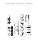 Identification of Micro-RNAS Involved in Post-Myocardial Infarction     Remodeling and Heart Failure diagram and image