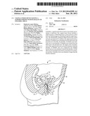 Vaginal Insert Device Having a Support Portion with Plurality of Foldable     Areas diagram and image