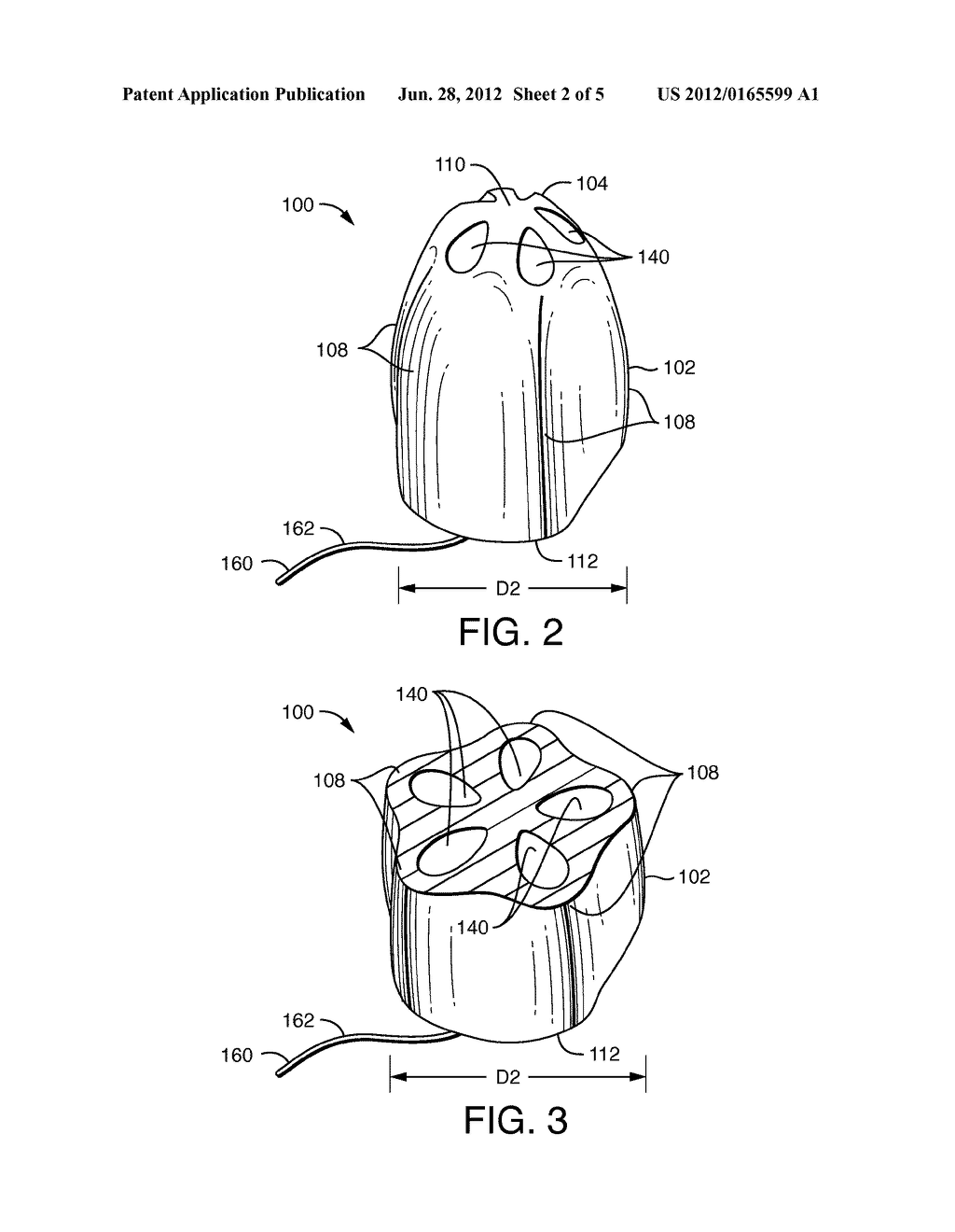 Vaginal Insert Device Having a Support Portion with Plurality of Foldable     Areas - diagram, schematic, and image 03