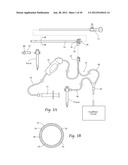 SYSTEMS AND METHODS FOR OPTIMIZING AND MAINTAINING VISUALIZATION OF A     SURGICAL FIELD DURING THE USE OF SURGICAL SCOPES diagram and image