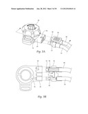 SYSTEMS AND METHODS FOR OPTIMIZING AND MAINTAINING VISUALIZATION OF A     SURGICAL FIELD DURING THE USE OF SURGICAL SCOPES diagram and image