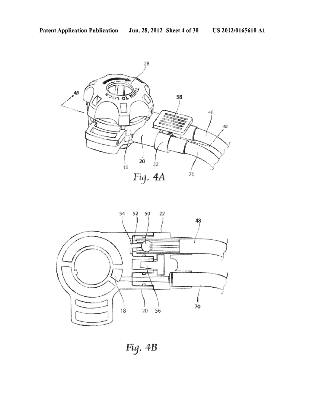 SYSTEMS AND METHODS FOR OPTIMIZING AND MAINTAINING VISUALIZATION OF A     SURGICAL FIELD DURING THE USE OF SURGICAL SCOPES - diagram, schematic, and image 05