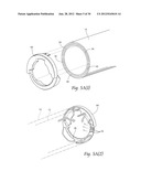 SYSTEMS AND METHODS FOR OPTIMIZING AND MAINTAINING VISUALIZATION OF A     SURGICAL FIELD DURING THE USE OF SURGICAL SCOPES diagram and image