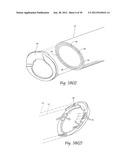 SYSTEMS AND METHODS FOR OPTIMIZING AND MAINTAINING VISUALIZATION OF A     SURGICAL FIELD DURING THE USE OF SURGICAL SCOPES diagram and image