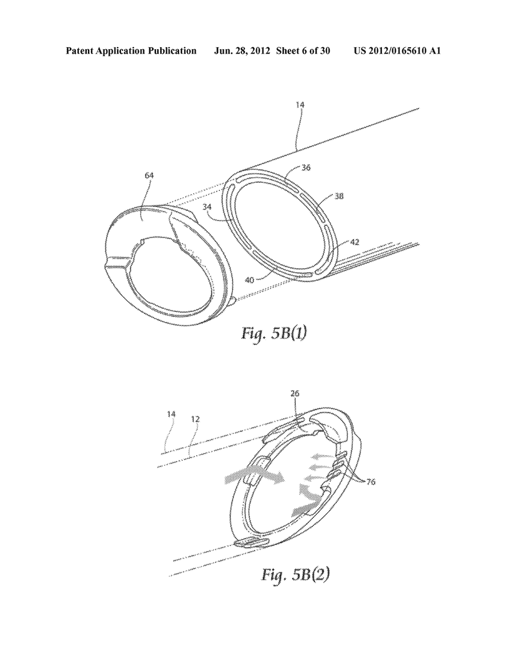 SYSTEMS AND METHODS FOR OPTIMIZING AND MAINTAINING VISUALIZATION OF A     SURGICAL FIELD DURING THE USE OF SURGICAL SCOPES - diagram, schematic, and image 07