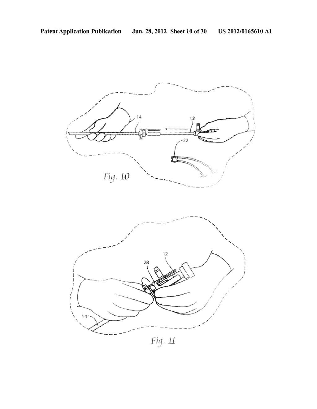 SYSTEMS AND METHODS FOR OPTIMIZING AND MAINTAINING VISUALIZATION OF A     SURGICAL FIELD DURING THE USE OF SURGICAL SCOPES - diagram, schematic, and image 11