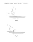 SYSTEMS AND METHODS FOR OPTIMIZING AND MAINTAINING VISUALIZATION OF A     SURGICAL FIELD DURING THE USE OF SURGICAL SCOPES diagram and image