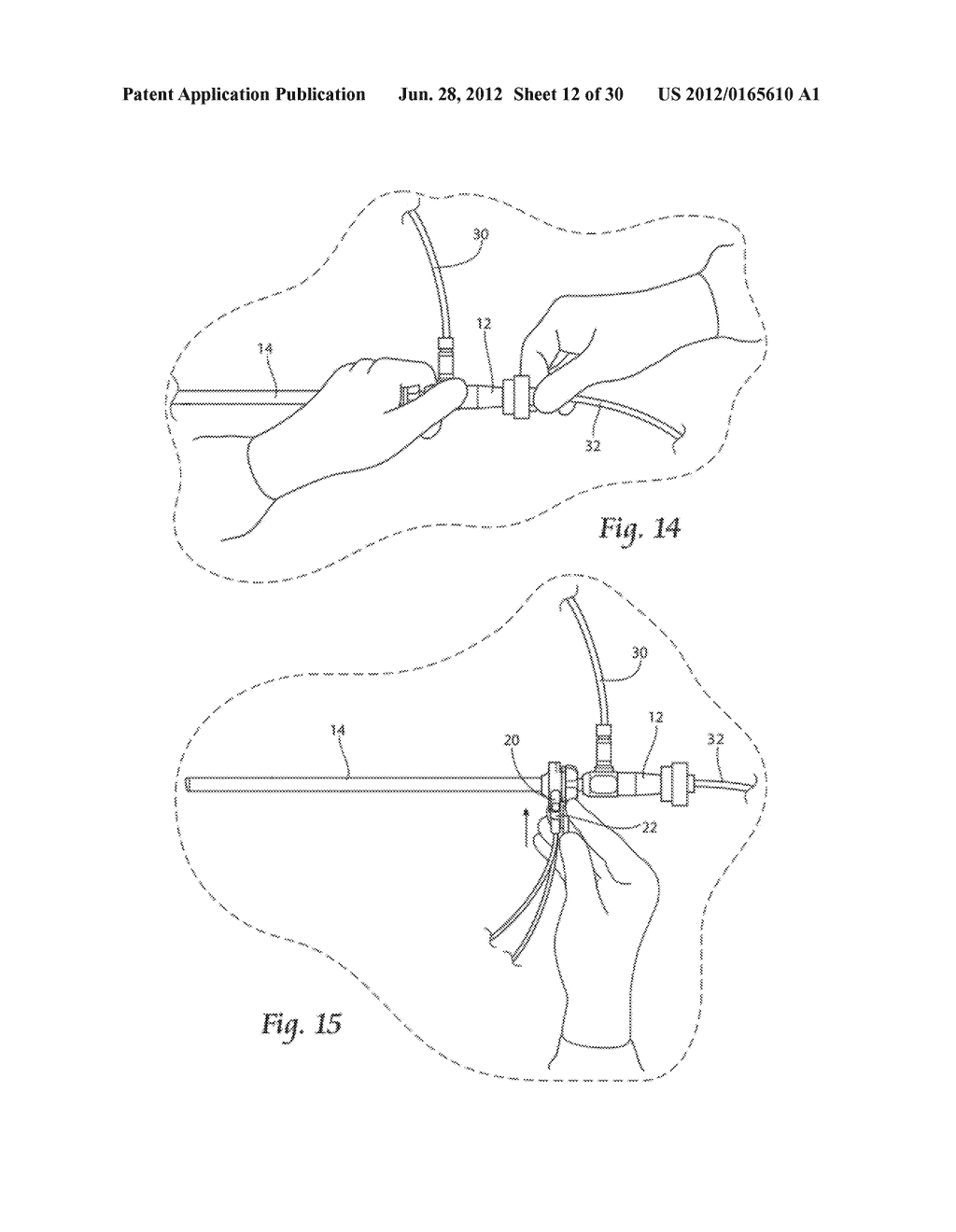 SYSTEMS AND METHODS FOR OPTIMIZING AND MAINTAINING VISUALIZATION OF A     SURGICAL FIELD DURING THE USE OF SURGICAL SCOPES - diagram, schematic, and image 13