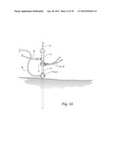 SYSTEMS AND METHODS FOR OPTIMIZING AND MAINTAINING VISUALIZATION OF A     SURGICAL FIELD DURING THE USE OF SURGICAL SCOPES diagram and image