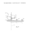 SYSTEMS AND METHODS FOR OPTIMIZING AND MAINTAINING VISUALIZATION OF A     SURGICAL FIELD DURING THE USE OF SURGICAL SCOPES diagram and image