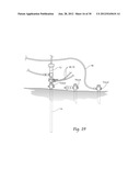 SYSTEMS AND METHODS FOR OPTIMIZING AND MAINTAINING VISUALIZATION OF A     SURGICAL FIELD DURING THE USE OF SURGICAL SCOPES diagram and image