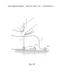 SYSTEMS AND METHODS FOR OPTIMIZING AND MAINTAINING VISUALIZATION OF A     SURGICAL FIELD DURING THE USE OF SURGICAL SCOPES diagram and image