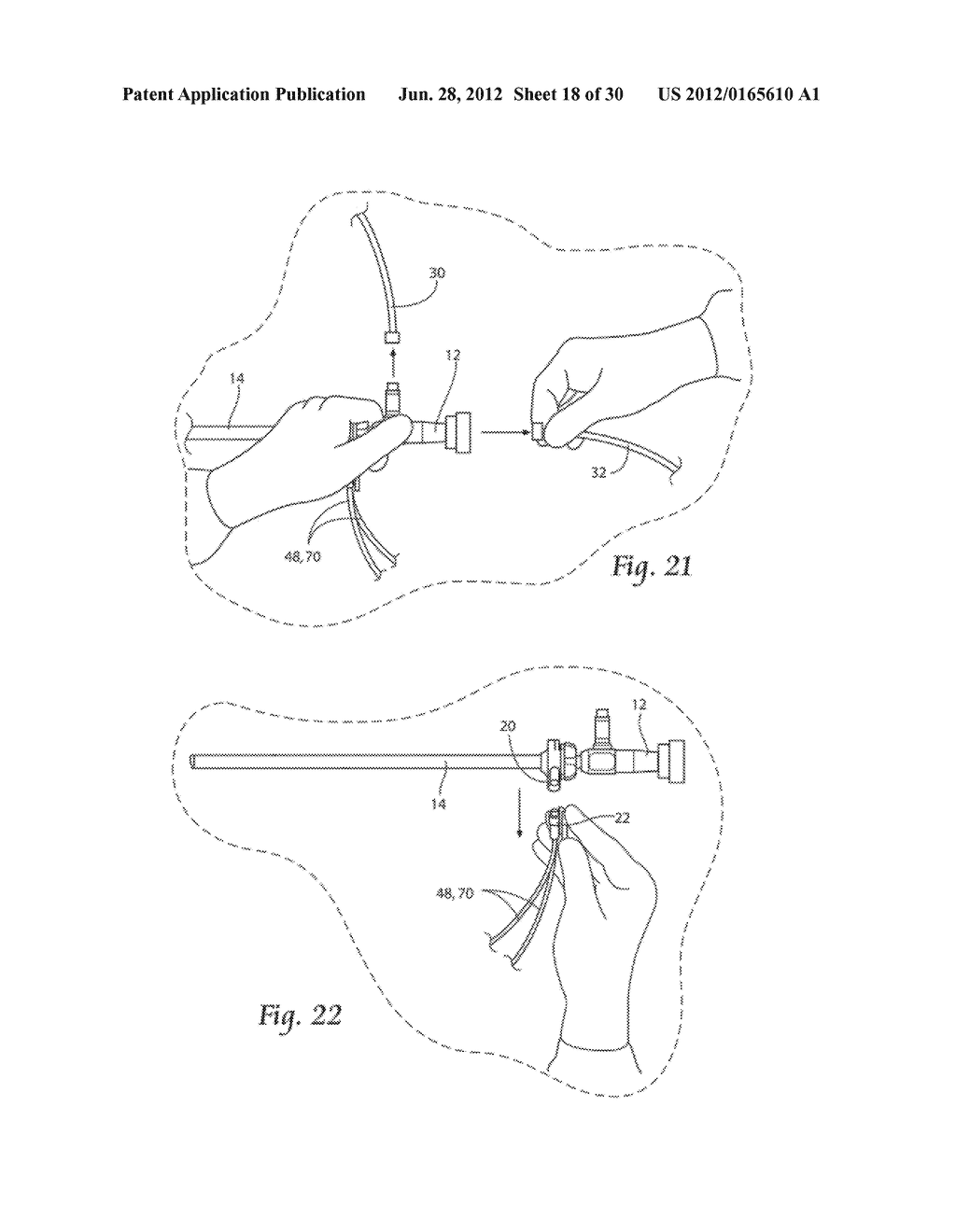 SYSTEMS AND METHODS FOR OPTIMIZING AND MAINTAINING VISUALIZATION OF A     SURGICAL FIELD DURING THE USE OF SURGICAL SCOPES - diagram, schematic, and image 19