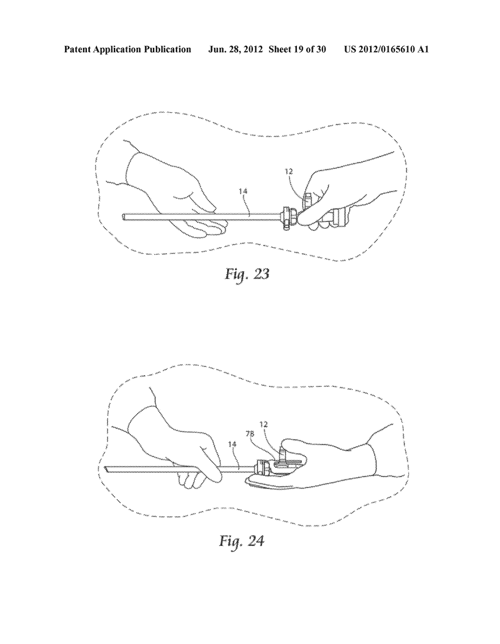 SYSTEMS AND METHODS FOR OPTIMIZING AND MAINTAINING VISUALIZATION OF A     SURGICAL FIELD DURING THE USE OF SURGICAL SCOPES - diagram, schematic, and image 20