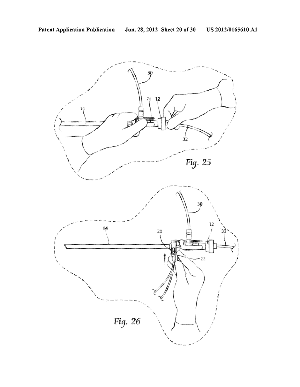 SYSTEMS AND METHODS FOR OPTIMIZING AND MAINTAINING VISUALIZATION OF A     SURGICAL FIELD DURING THE USE OF SURGICAL SCOPES - diagram, schematic, and image 21