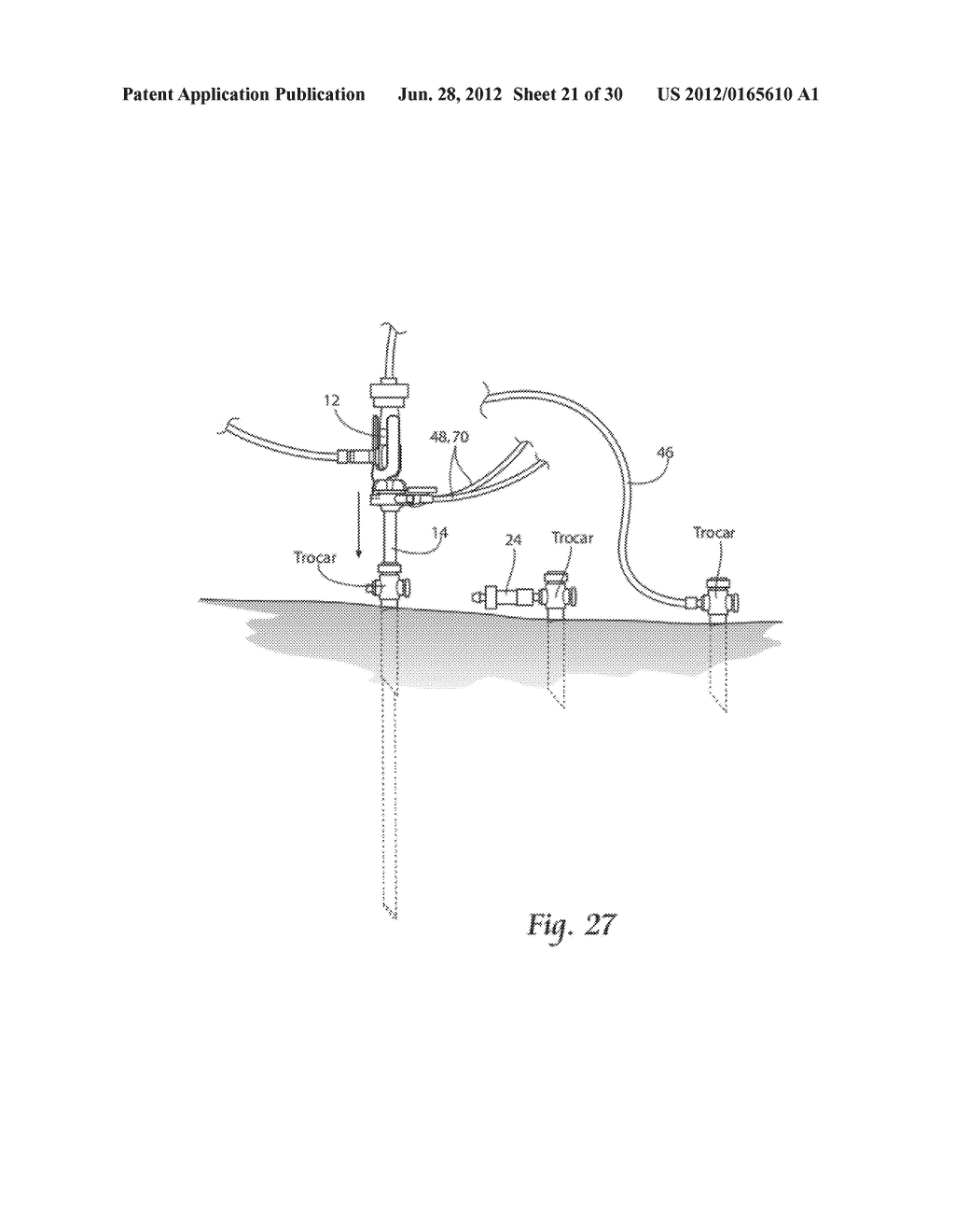 SYSTEMS AND METHODS FOR OPTIMIZING AND MAINTAINING VISUALIZATION OF A     SURGICAL FIELD DURING THE USE OF SURGICAL SCOPES - diagram, schematic, and image 22