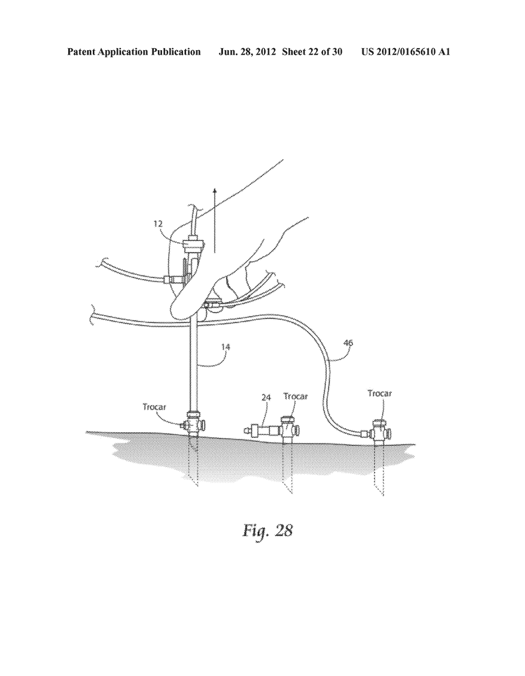 SYSTEMS AND METHODS FOR OPTIMIZING AND MAINTAINING VISUALIZATION OF A     SURGICAL FIELD DURING THE USE OF SURGICAL SCOPES - diagram, schematic, and image 23