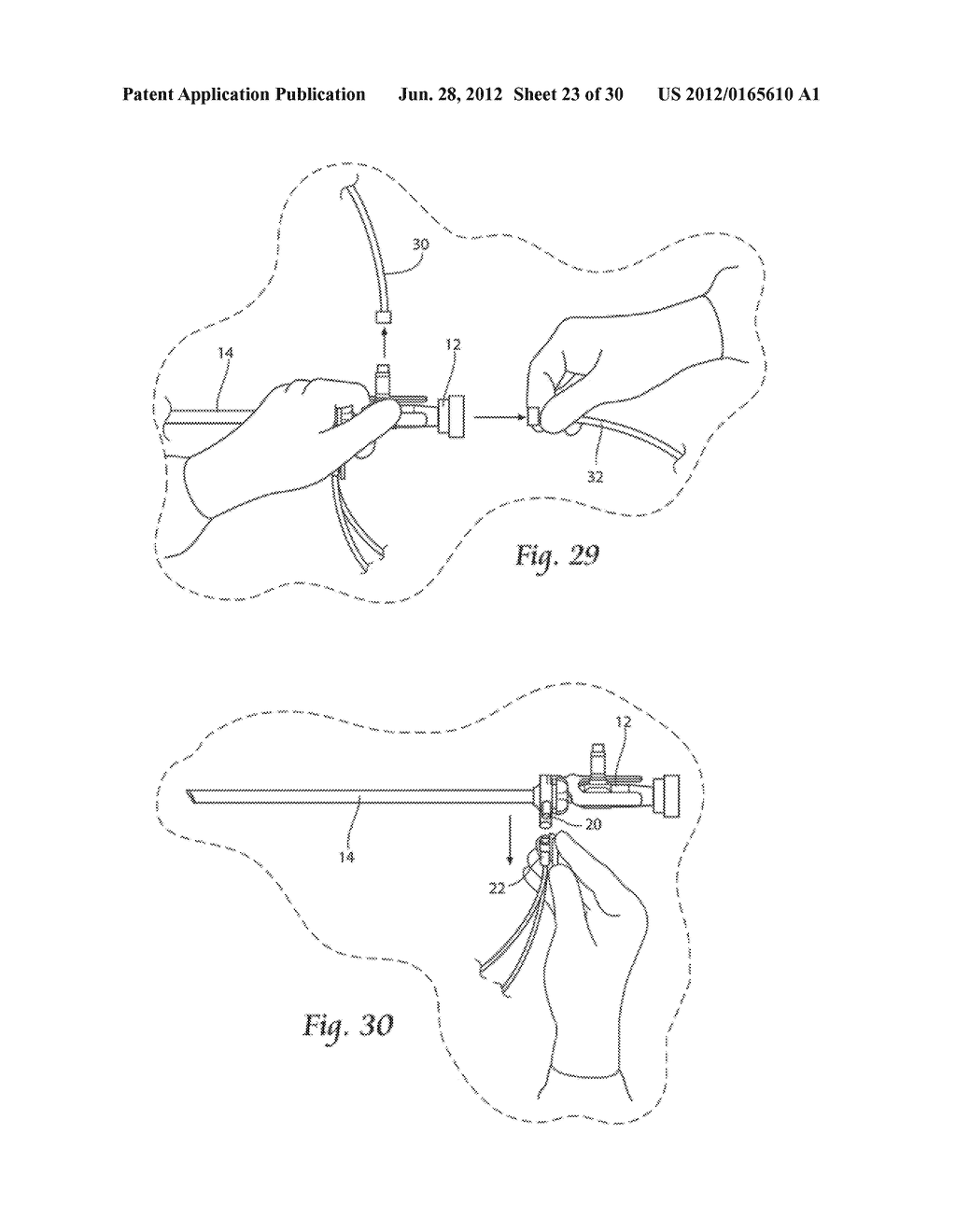 SYSTEMS AND METHODS FOR OPTIMIZING AND MAINTAINING VISUALIZATION OF A     SURGICAL FIELD DURING THE USE OF SURGICAL SCOPES - diagram, schematic, and image 24