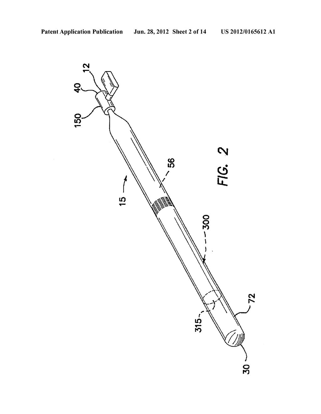 TAMPONADE TROCAR DEVICE AND METHOD - diagram, schematic, and image 03