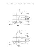 Systems and methods for treating acute and/or chronic injuries in soft     tissue diagram and image