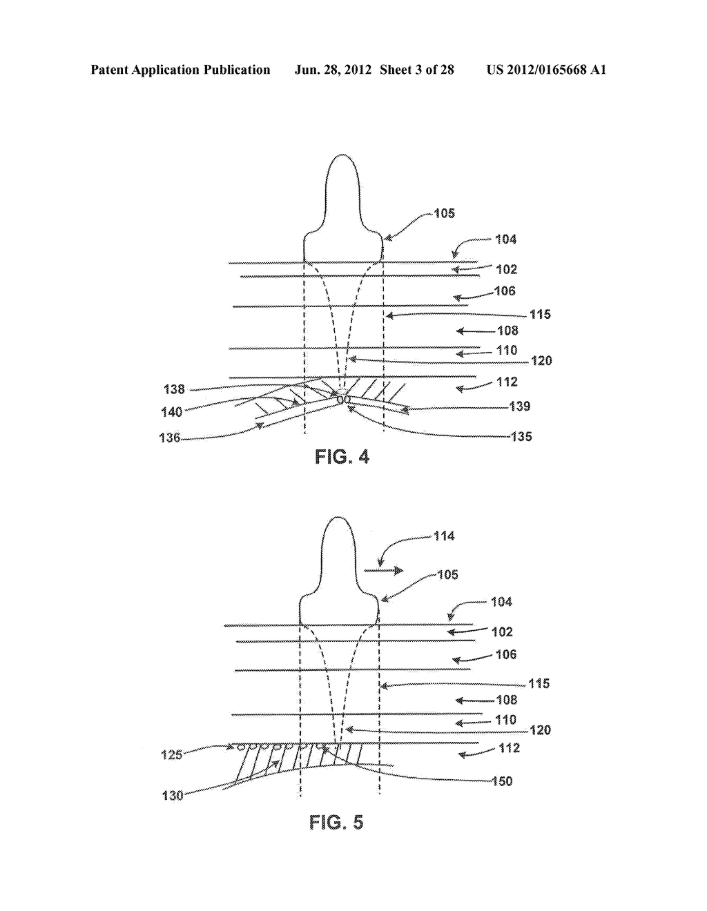 Systems and methods for treating acute and/or chronic injuries in soft     tissue - diagram, schematic, and image 04