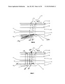 Systems and methods for treating acute and/or chronic injuries in soft     tissue diagram and image