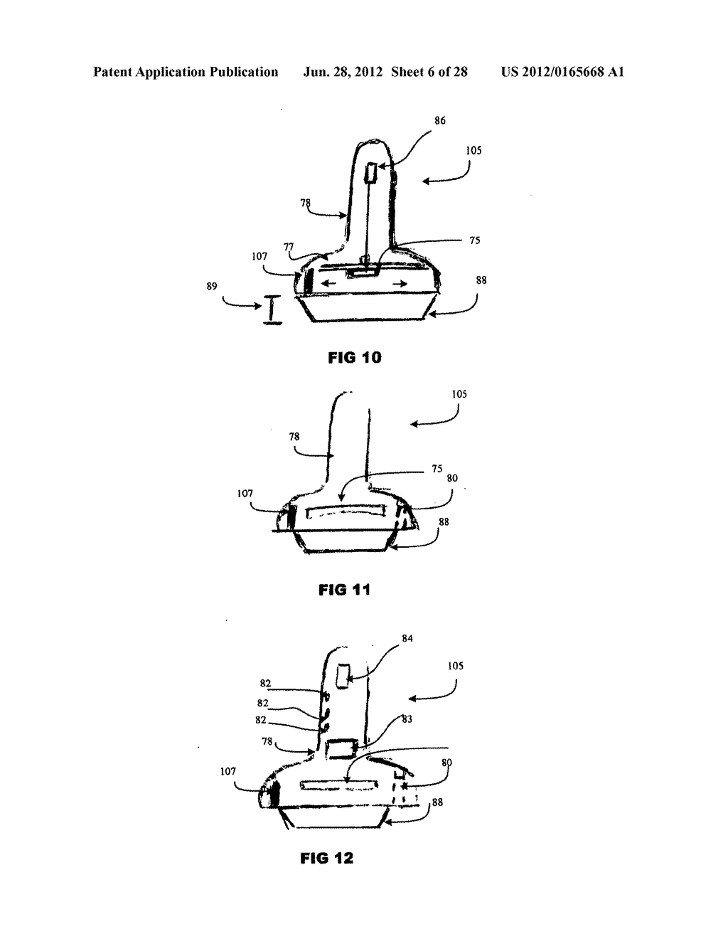 Systems and methods for treating acute and/or chronic injuries in soft     tissue - diagram, schematic, and image 07