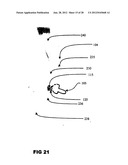 Systems and methods for treating acute and/or chronic injuries in soft     tissue diagram and image