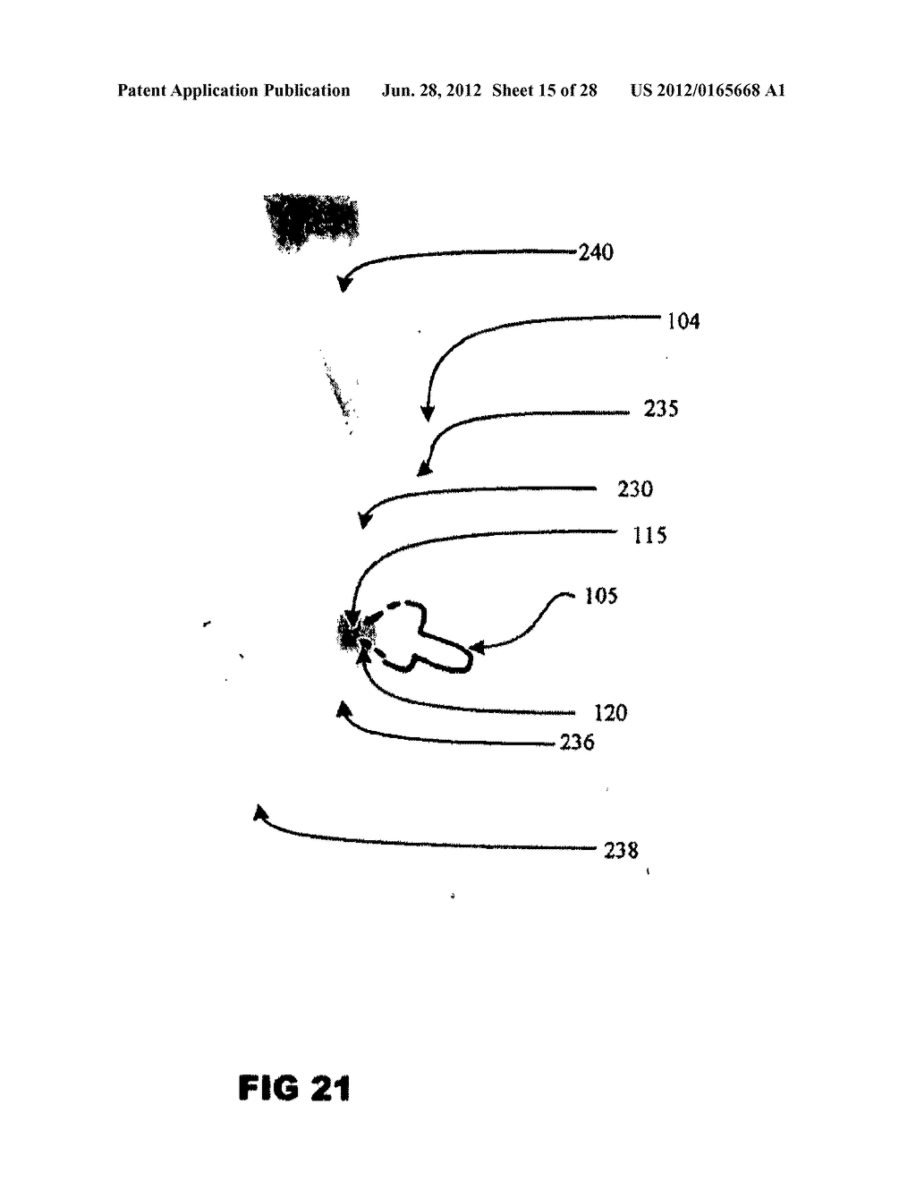 Systems and methods for treating acute and/or chronic injuries in soft     tissue - diagram, schematic, and image 16