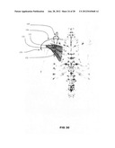 Systems and methods for treating acute and/or chronic injuries in soft     tissue diagram and image