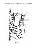 Systems and methods for treating acute and/or chronic injuries in soft     tissue diagram and image