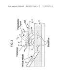 ACOUSTIC ACCESS DISCONNECTION SYSTEMS AND METHODS diagram and image