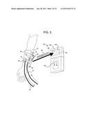 ACOUSTIC ACCESS DISCONNECTION SYSTEMS AND METHODS diagram and image