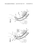 ACOUSTIC ACCESS DISCONNECTION SYSTEMS AND METHODS diagram and image