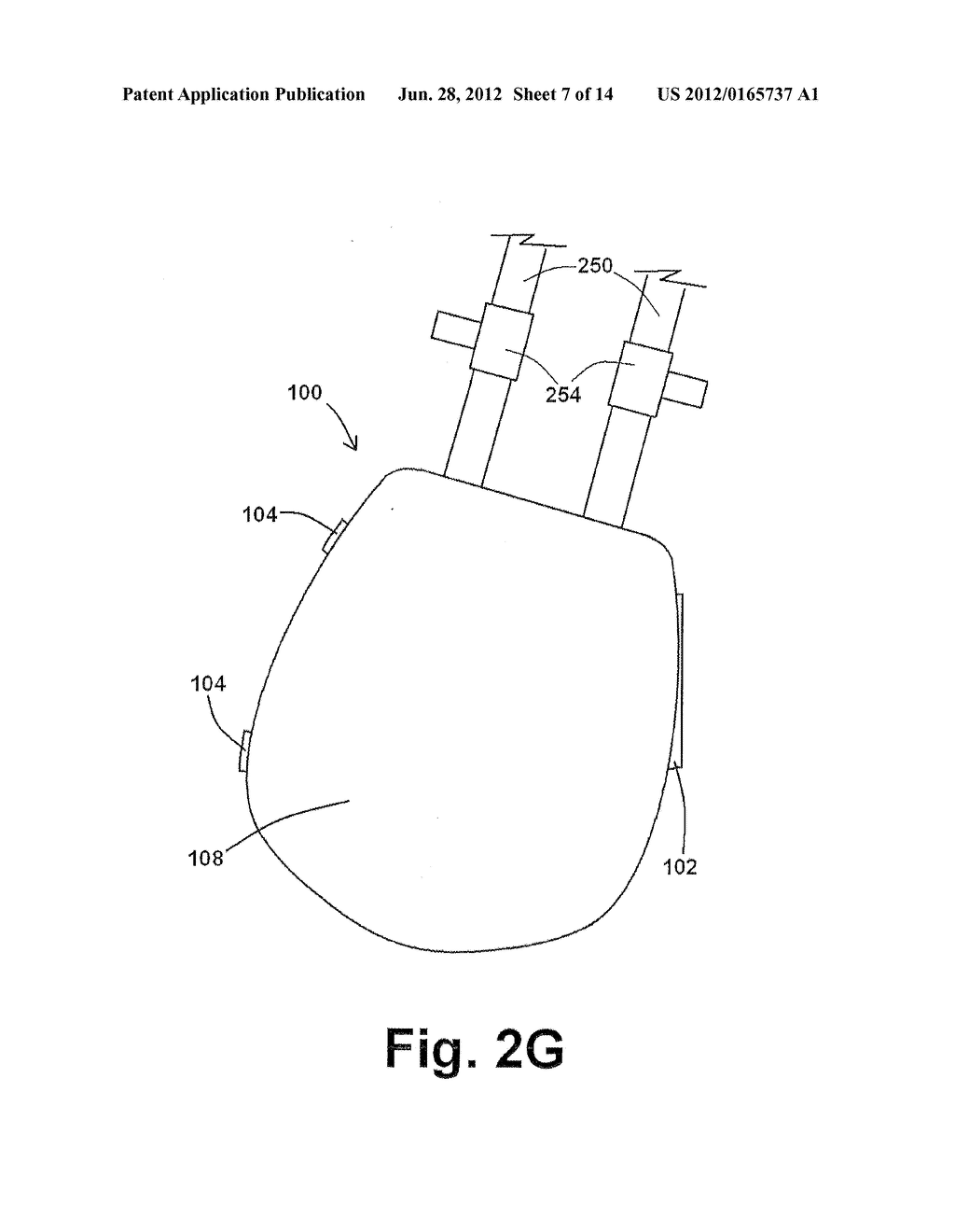 DEVICES AND METHODS FOR MAINTAINING AN ASEPTIC CATHETER ENVIRONMENT - diagram, schematic, and image 08