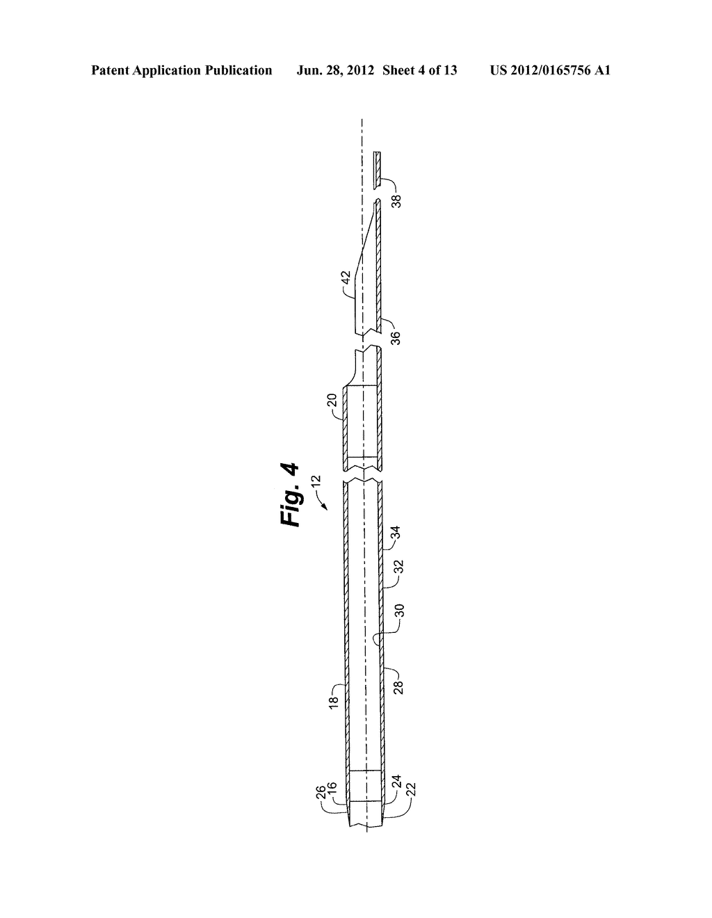 COAXIAL GUIDE CATHETER FOR INTERVENTIONAL CARDIOLOGY PROCEDURES - diagram, schematic, and image 05