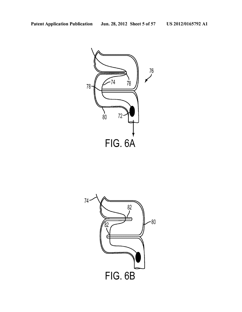 Pill Catchers - diagram, schematic, and image 06