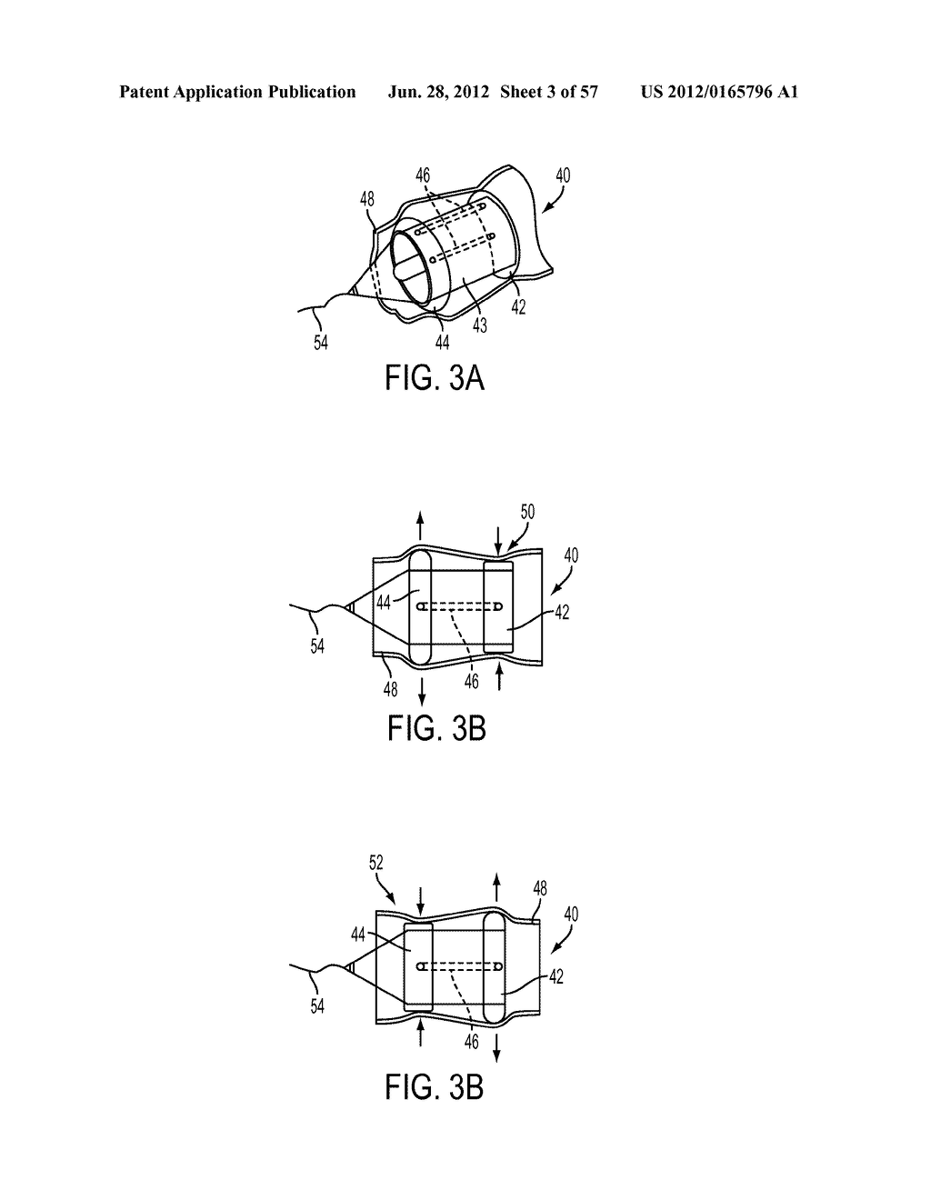 Pill Catchers - diagram, schematic, and image 04