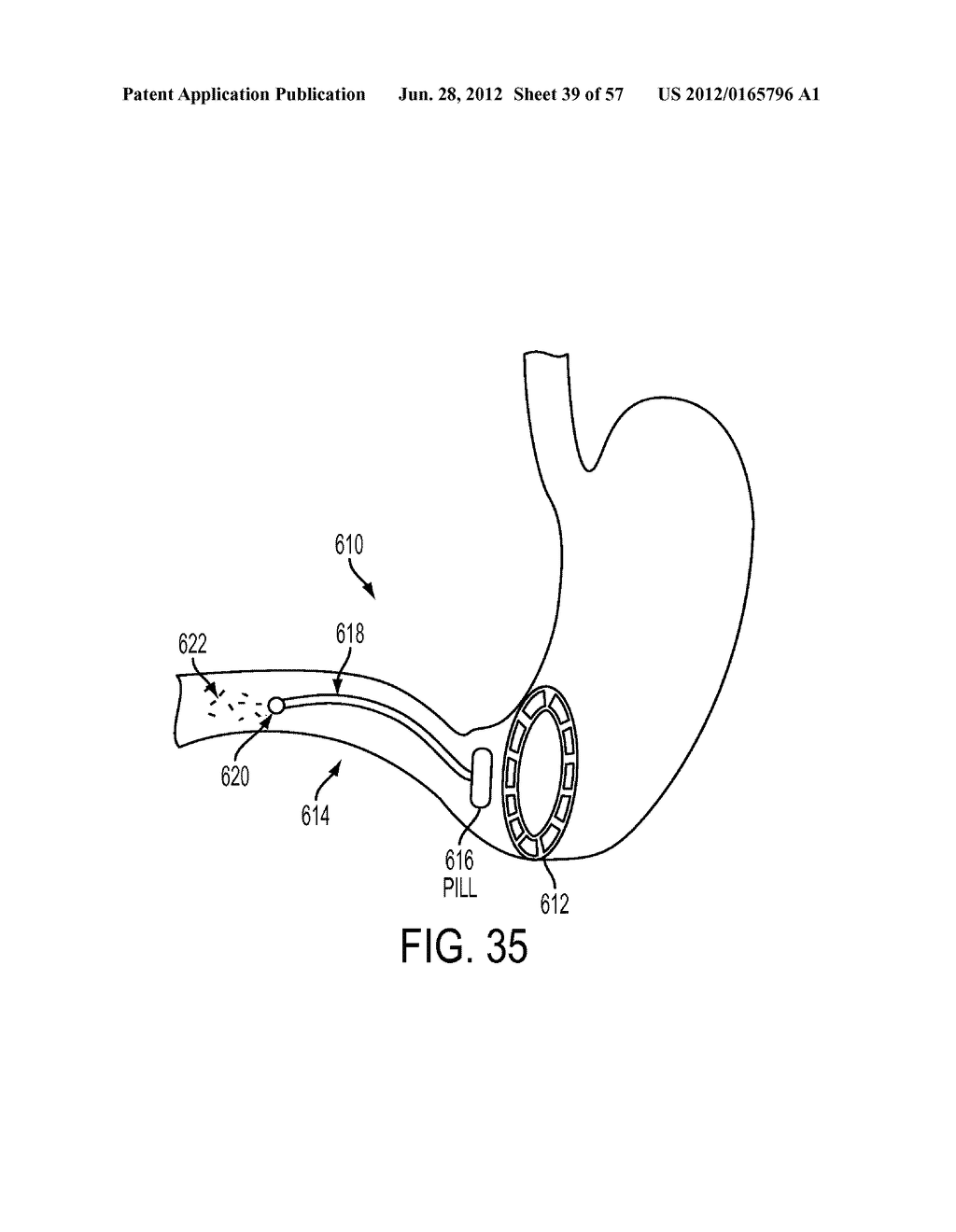 Pill Catchers - diagram, schematic, and image 40