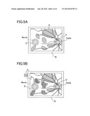 OPHTHALMIC LASER TREATMENT APPARATUS diagram and image