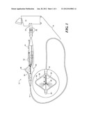 METHOD AND SYSTEM TO PREVENT COMPLETE OBSTRUCTION IN CATHETER IN CASE OF A     KINK diagram and image