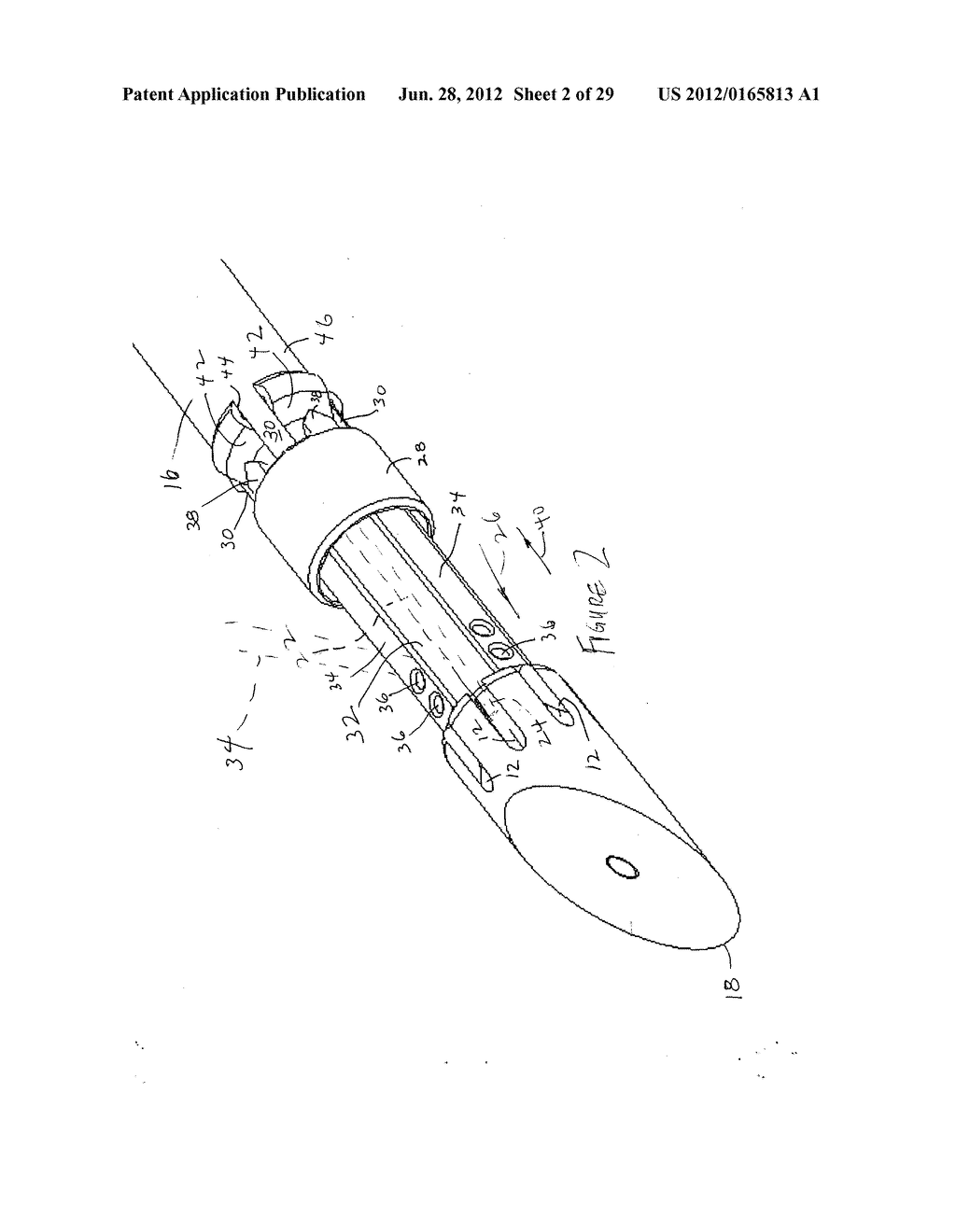 RADIO FREQUENCY ABLATION DEVICE FOR THE DESTRUCTION OF TISSUE MASSES - diagram, schematic, and image 03