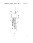 RADIO FREQUENCY ABLATION DEVICE FOR THE DESTRUCTION OF TISSUE MASSES diagram and image