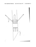 RADIO FREQUENCY ABLATION DEVICE FOR THE DESTRUCTION OF TISSUE MASSES diagram and image