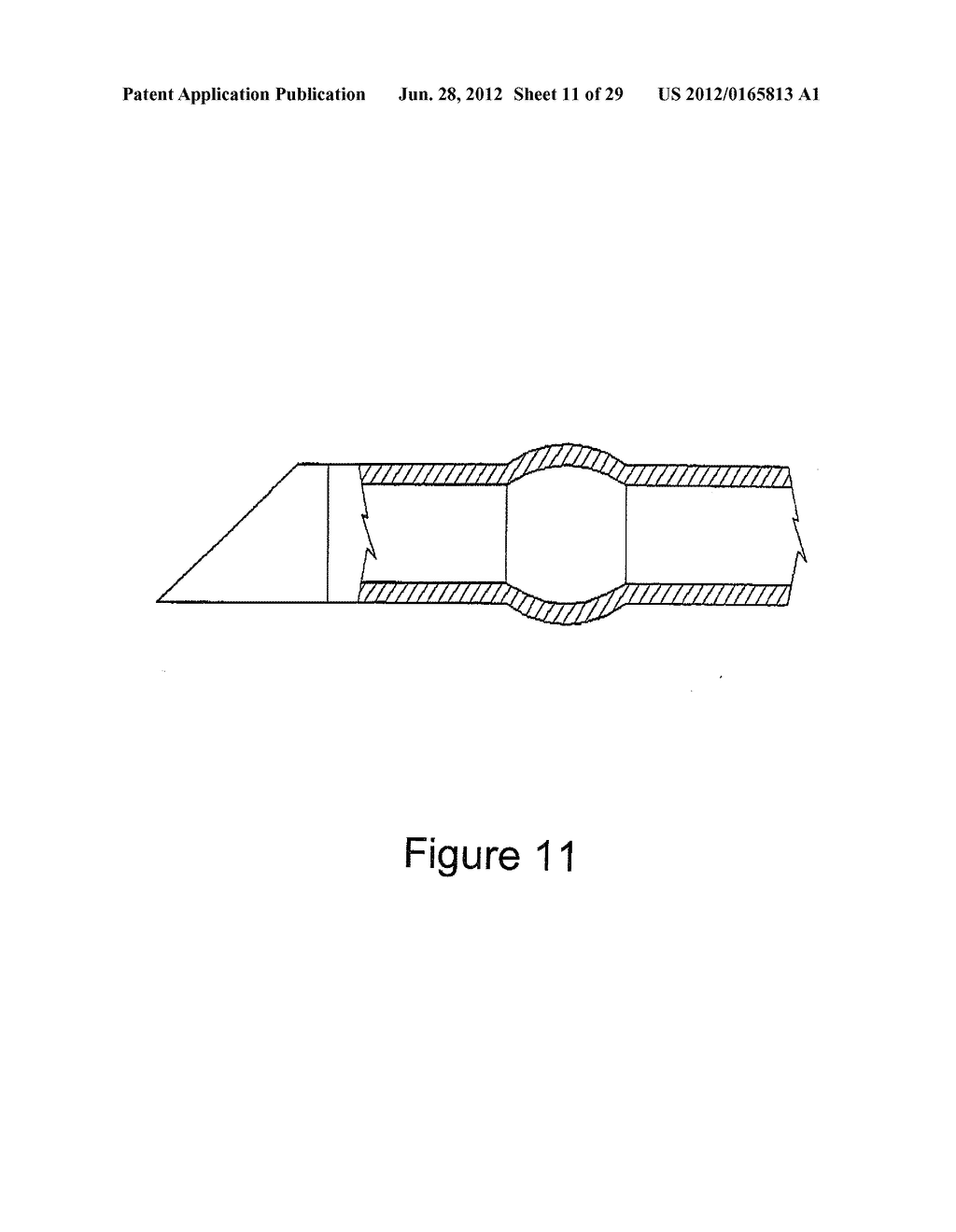 RADIO FREQUENCY ABLATION DEVICE FOR THE DESTRUCTION OF TISSUE MASSES - diagram, schematic, and image 12