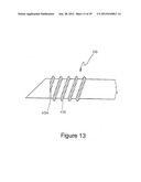 RADIO FREQUENCY ABLATION DEVICE FOR THE DESTRUCTION OF TISSUE MASSES diagram and image