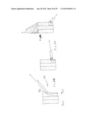 RADIO FREQUENCY ABLATION DEVICE FOR THE DESTRUCTION OF TISSUE MASSES diagram and image